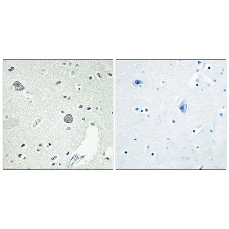Immunohistochemistry - Anti-DRD1 Antibody (G076) - Antibodies.com