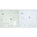Immunohistochemistry - Anti-DRD1 Antibody (G076) - Antibodies.com