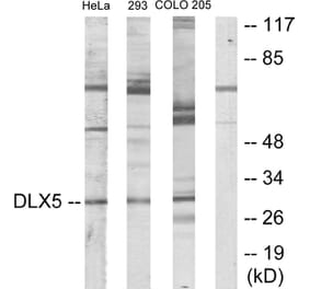 Western Blot - Anti-DLX5 Antibody (C10748) - Antibodies.com