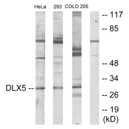 Western Blot - Anti-DLX5 Antibody (C10748) - Antibodies.com