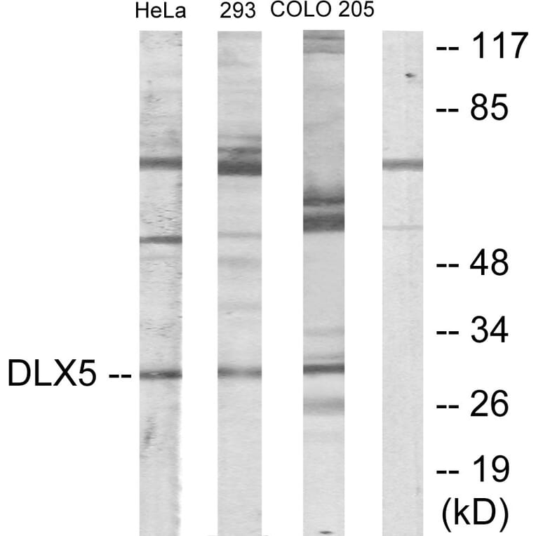 Western Blot - Anti-DLX5 Antibody (C10748) - Antibodies.com