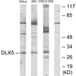 Western Blot - Anti-DLX5 Antibody (C10748) - Antibodies.com
