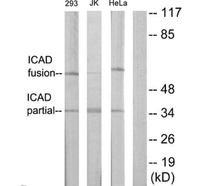 Western Blot - Anti-DFFA Antibody (C13041) - Antibodies.com