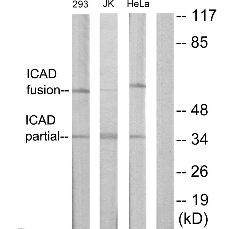 Western Blot - Anti-DFFA Antibody (C13041) - Antibodies.com