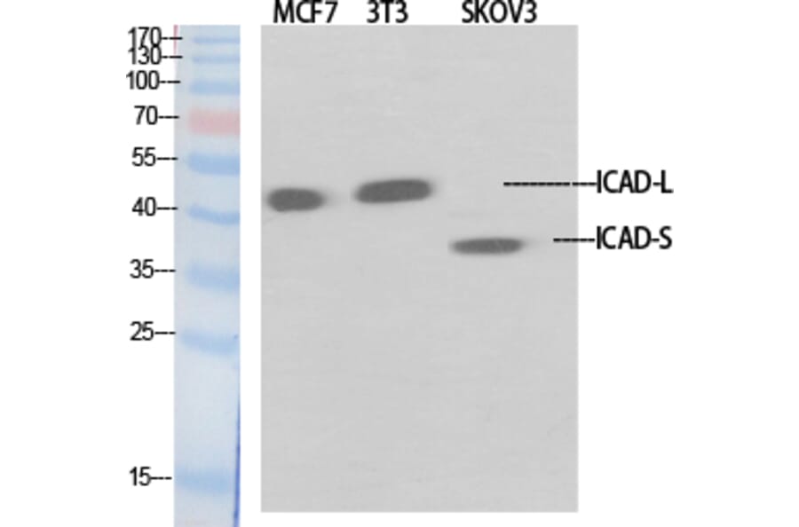 Western Blot - Anti-DFFA Antibody (C13041) - Antibodies.com