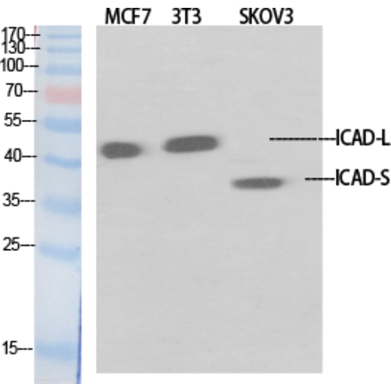 Western Blot - Anti-DFFA Antibody (C13041) - Antibodies.com