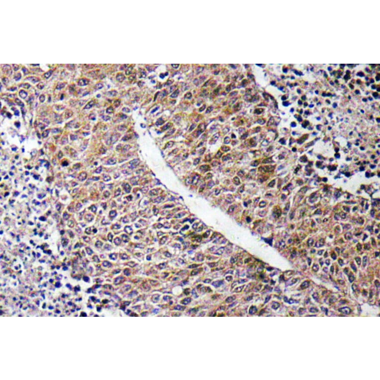 Immunohistochemistry - Anti-CTPS Antibody (R12-2105) - Antibodies.com