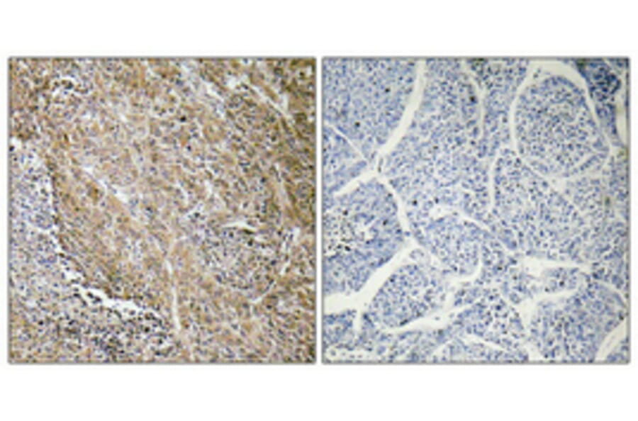 Immunohistochemistry - Anti-CTPS Antibody (R12-2105) - Antibodies.com