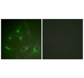 Immunofluorescence - Anti-CSFR Antibody (B0877) - Antibodies.com