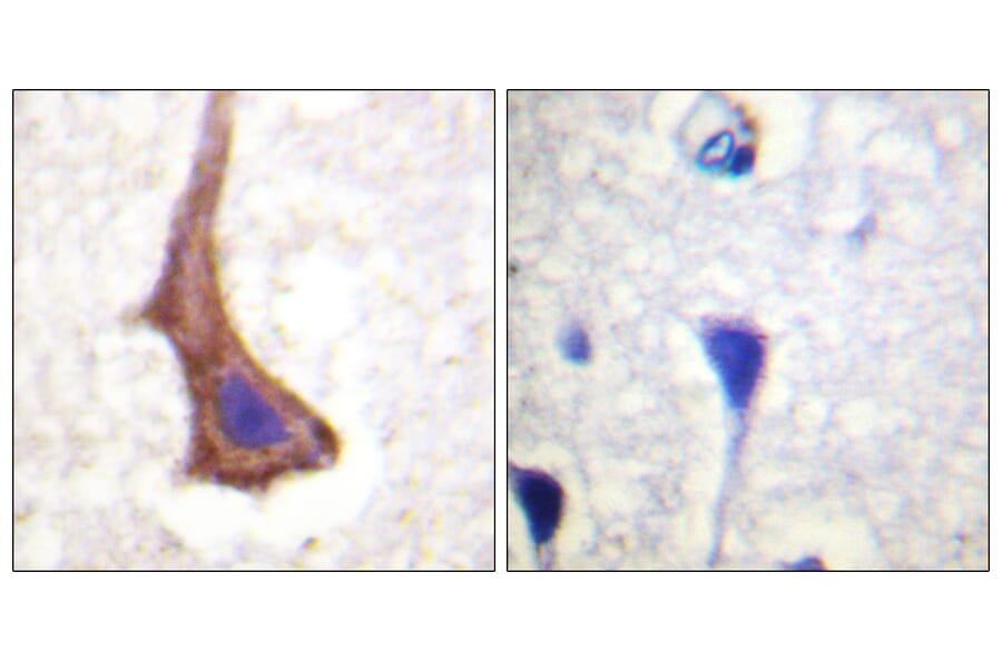 Immunohistochemistry - Anti-CSFR Antibody (B0877) - Antibodies.com