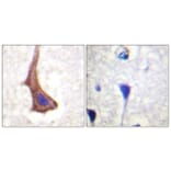 Immunohistochemistry - Anti-CSFR Antibody (B0877) - Antibodies.com