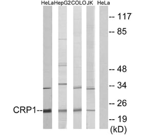 Western Blot - Anti-CRP1 Antibody (C10443) - Antibodies.com