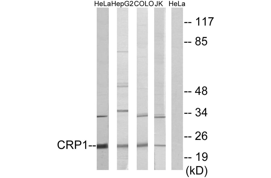 Western Blot - Anti-CRP1 Antibody (C10443) - Antibodies.com