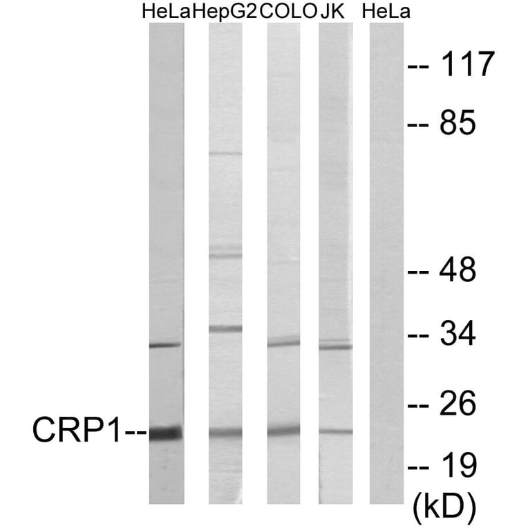 Western Blot - Anti-CRP1 Antibody (C10443) - Antibodies.com