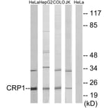 Western Blot - Anti-CRP1 Antibody (C10443) - Antibodies.com