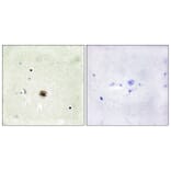 Immunohistochemistry - Anti-CRP1 Antibody (C10443) - Antibodies.com