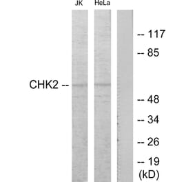 Western Blot - Anti-Chk2 Antibody (B7044) - Antibodies.com