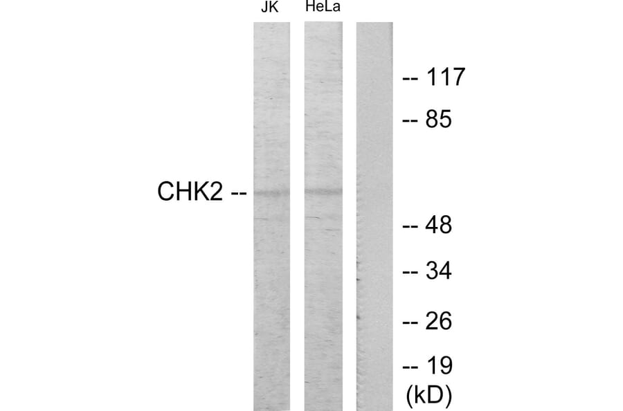 Western Blot - Anti-Chk2 Antibody (B7044) - Antibodies.com