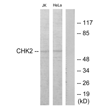 Western Blot - Anti-Chk2 Antibody (B7044) - Antibodies.com
