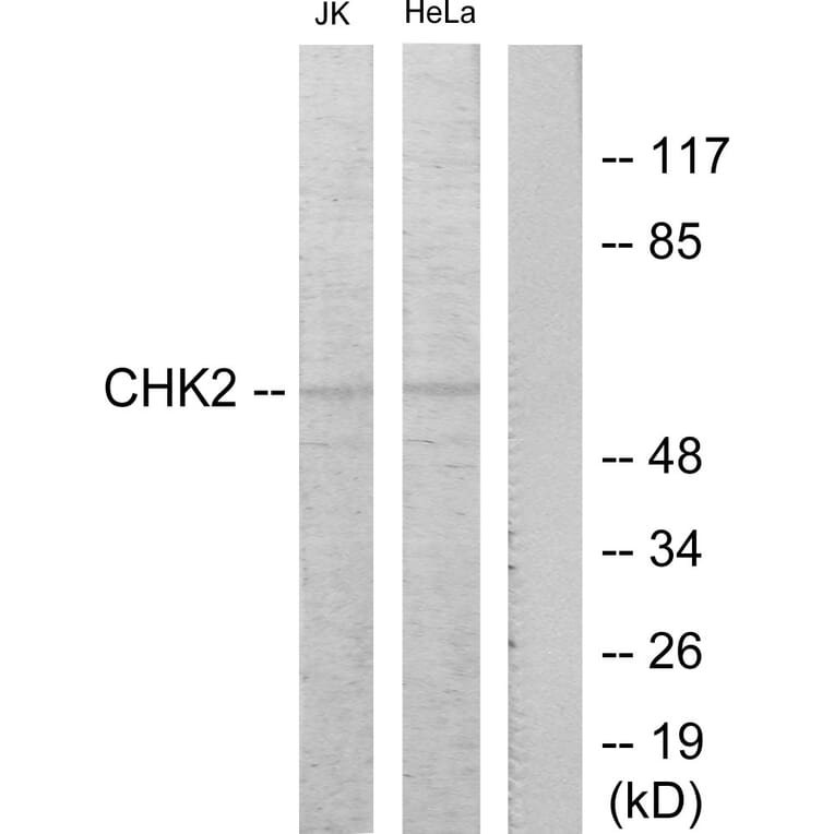 Western Blot - Anti-Chk2 Antibody (B7044) - Antibodies.com