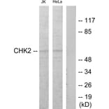 Western Blot - Anti-Chk2 Antibody (B7044) - Antibodies.com