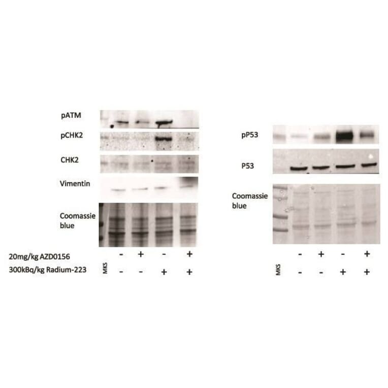 Western Blot - Anti-Chk2 Antibody - Antibodies.com