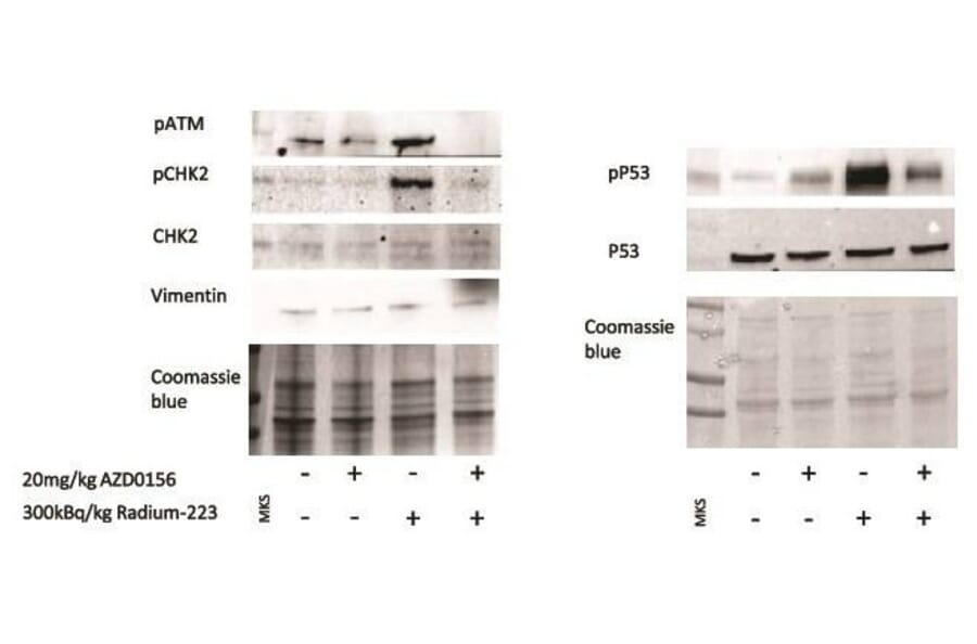 Western Blot - Anti-Chk2 Antibody - Antibodies.com
