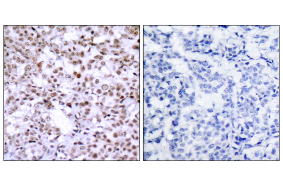 Immunohistochemistry - Anti-Chk2 Antibody (B7044) - Antibodies.com