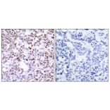 Immunohistochemistry - Anti-Chk2 Antibody (B7044) - Antibodies.com