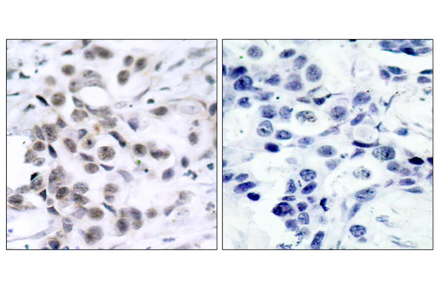 Immunohistochemistry - Anti-Chk1 Antibody (B7041) - Antibodies.com