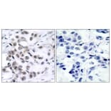 Immunohistochemistry - Anti-Chk1 Antibody (B7041) - Antibodies.com