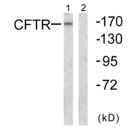 Western Blot - Anti-CFTR Antibody (B0860) - Antibodies.com