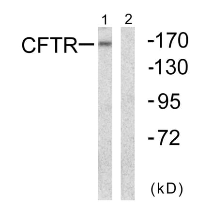 Western Blot - Anti-CFTR Antibody (B0860) - Antibodies.com