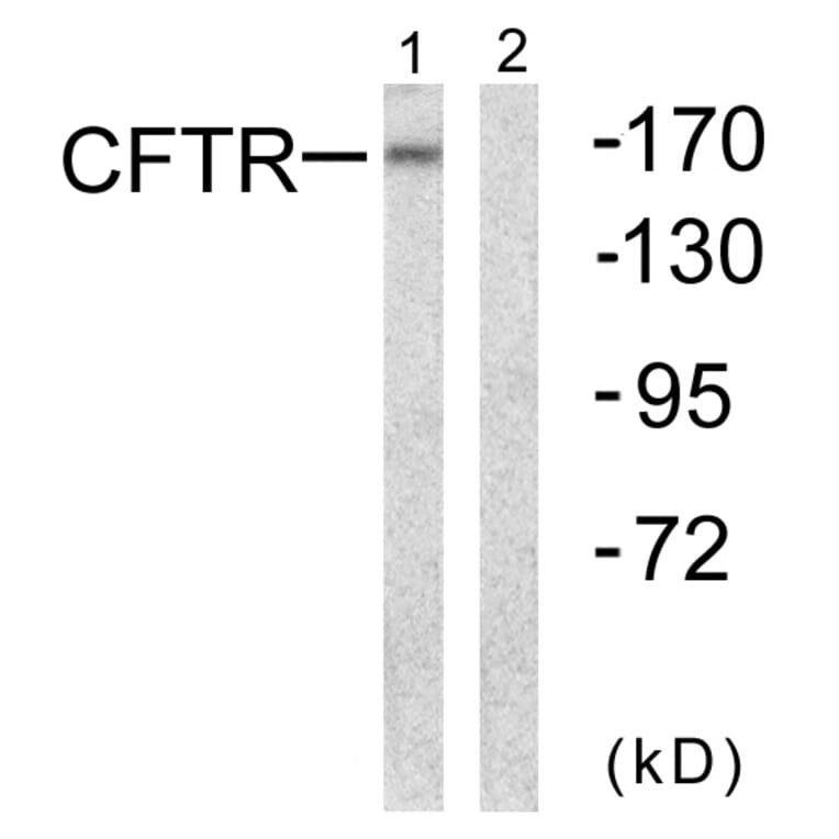 Western Blot - Anti-CFTR Antibody (B0860) - Antibodies.com