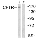 Western Blot - Anti-CFTR Antibody (B0860) - Antibodies.com