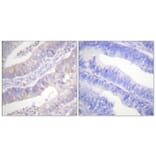 Immunohistochemistry - Anti-CFTR Antibody (B0860) - Antibodies.com