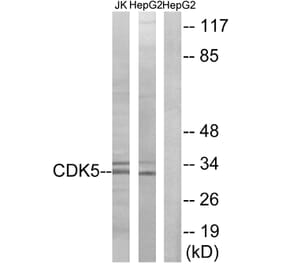 Western Blot - Anti-CDK5 Antibody (B1141) - Antibodies.com