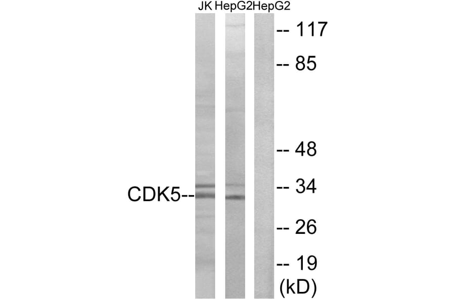 Western Blot - Anti-CDK5 Antibody (B1141) - Antibodies.com
