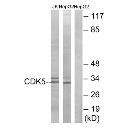 Western Blot - Anti-CDK5 Antibody (B1141) - Antibodies.com