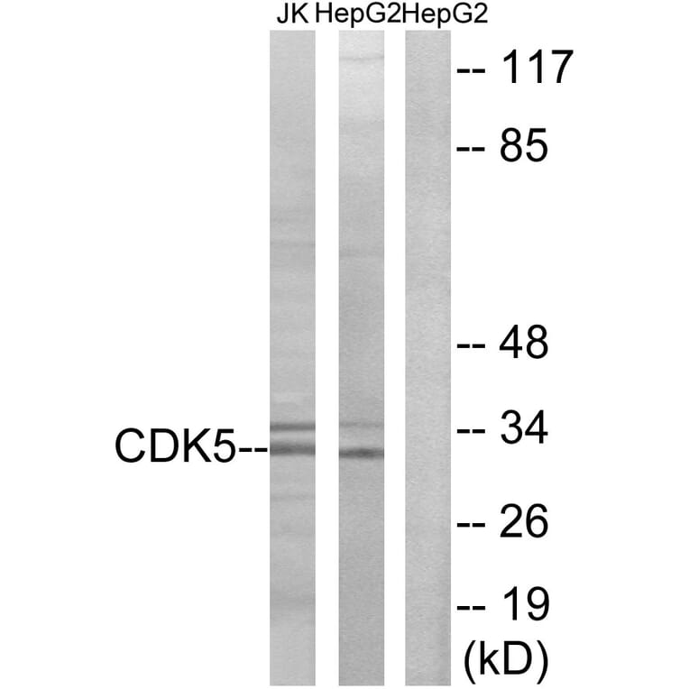 Western Blot - Anti-CDK5 Antibody (B1141) - Antibodies.com