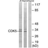 Western Blot - Anti-CDK5 Antibody (B1141) - Antibodies.com