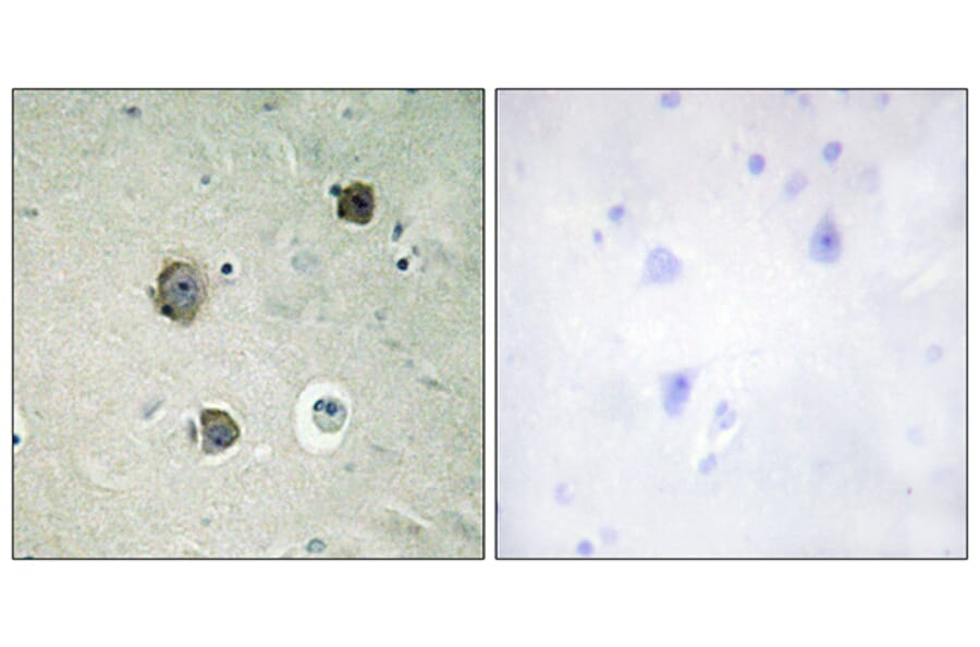 Immunohistochemistry - Anti-CDK5 Antibody (B1141) - Antibodies.com