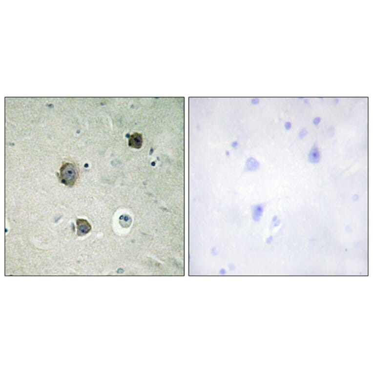 Immunohistochemistry - Anti-CDK5 Antibody (B1141) - Antibodies.com