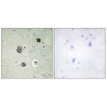 Immunohistochemistry - Anti-CDK5 Antibody (B1141) - Antibodies.com