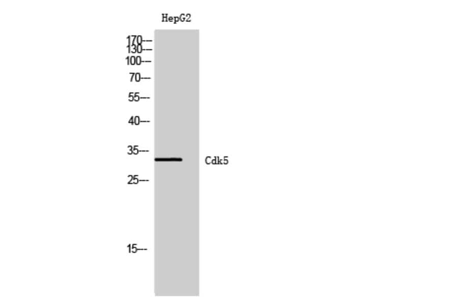 Western Blot - Anti-CDK5 Antibody (B1141) - Antibodies.com
