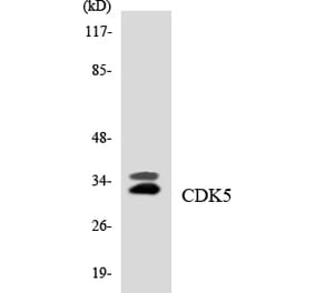 Western Blot - Anti-CDK5 Antibody (R12-2605) - Antibodies.com