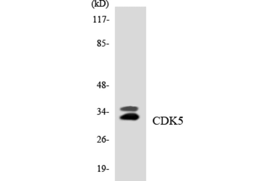 Western Blot - Anti-CDK5 Antibody (R12-2605) - Antibodies.com