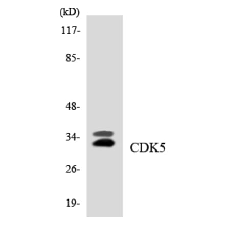 Western Blot - Anti-CDK5 Antibody (R12-2605) - Antibodies.com
