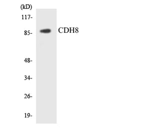 Western Blot - Anti-CDH8 Antibody (R12-2602) - Antibodies.com