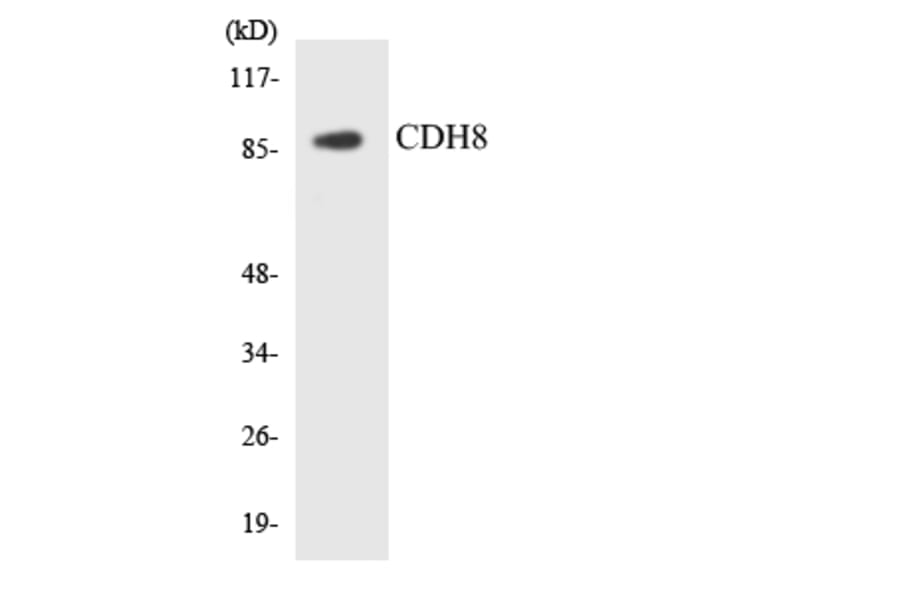Western Blot - Anti-CDH8 Antibody (R12-2602) - Antibodies.com